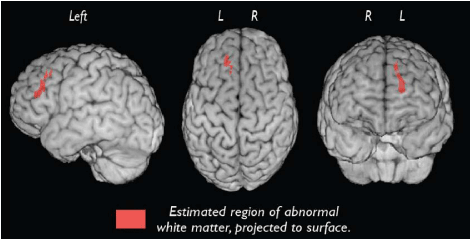 Coronal Vs Sagittal