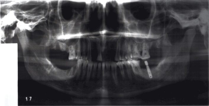 Opg Anatomy