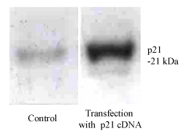 P21 Gene