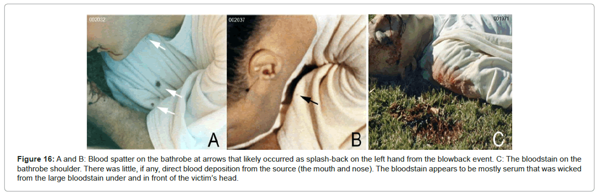 forensic-research-Blood-spatter-bathrobe
