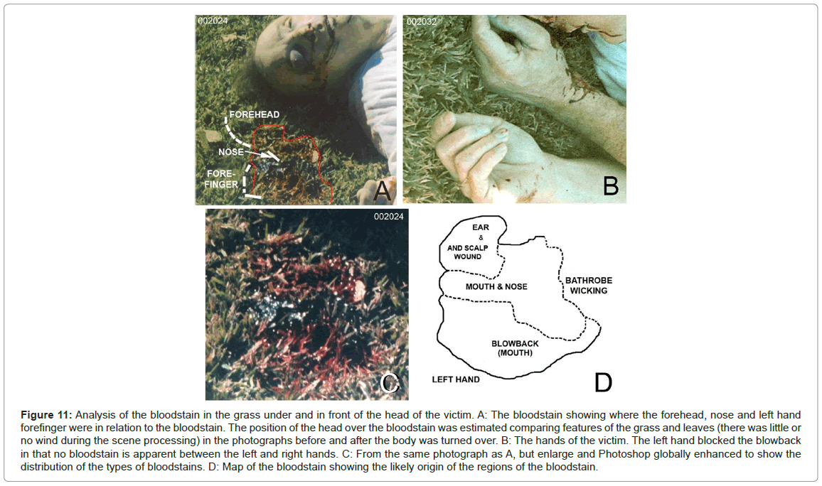 forensic-research-photographs-before-after-body-turned-over