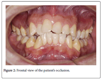 otolaryngology-Frontal-patient-occlusion