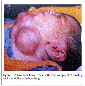 otolaryngology-born-female-chief-swelling