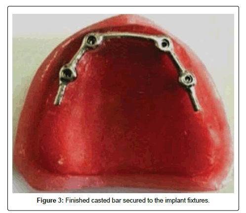 oral-hygiene-and-health-casted