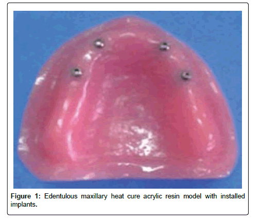 oral-hygiene-and-health-maxillary