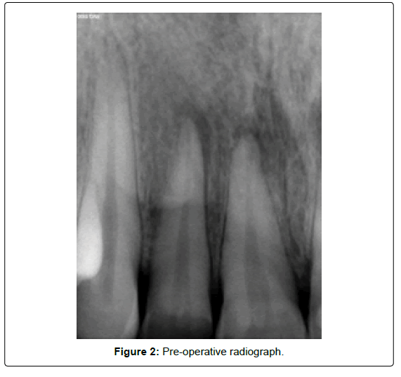 oral-hygiene-and-health-radiograph