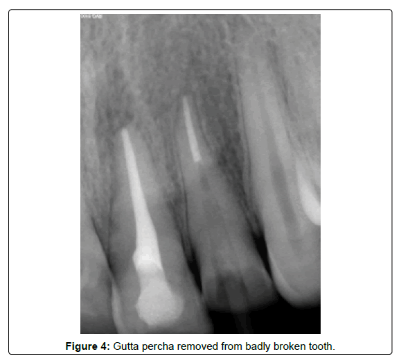 oral-hygiene-and-health-tooth