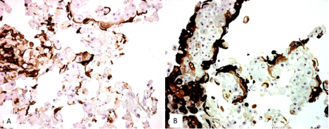 keratinocytes