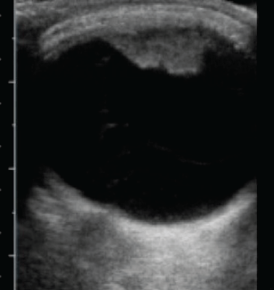 ciliary