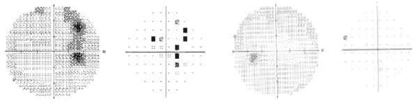 figure-3