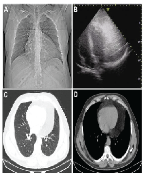 Preoperative