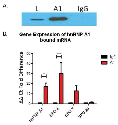 Immunoprecipitation