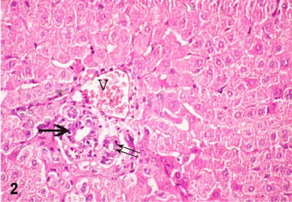 treated group II showing enlarged hepatocytes