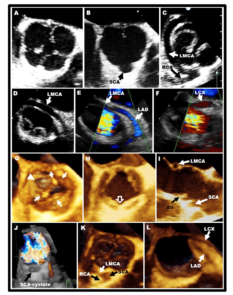 Echocardiographic