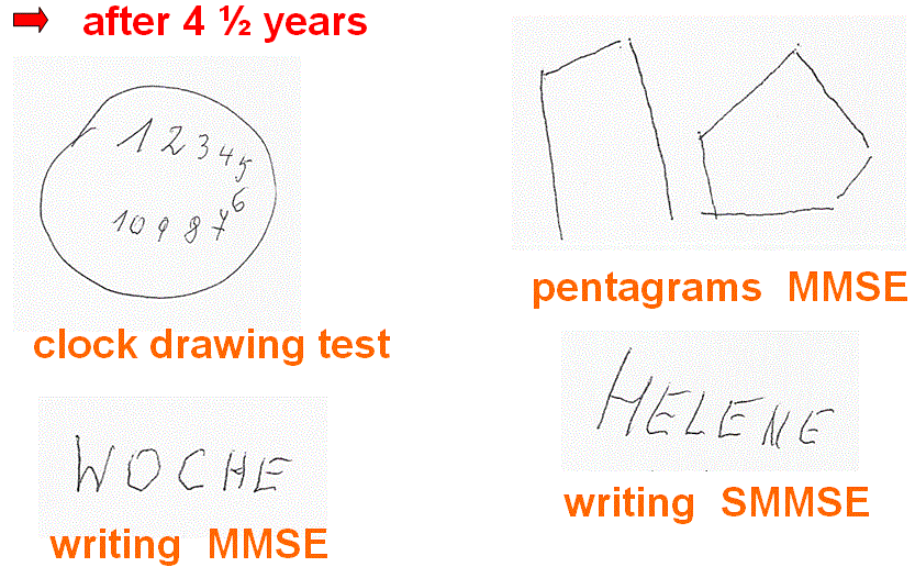 figure-4-mini-mental-state-examination-mmse