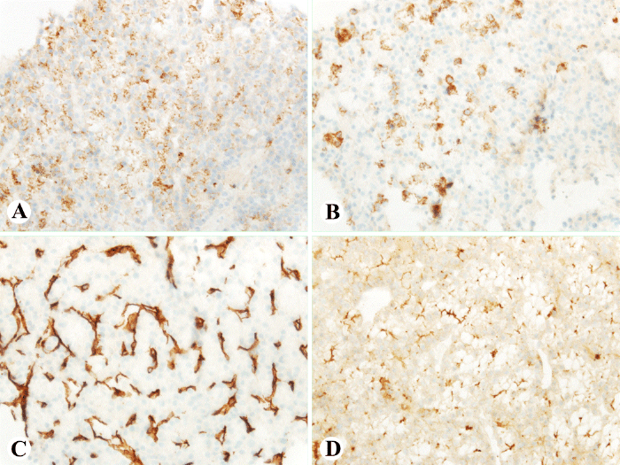 Immunohistochemistry