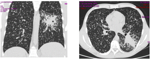 btc radiology