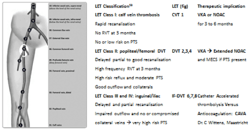 Deep Vein Thrombosis Classifications