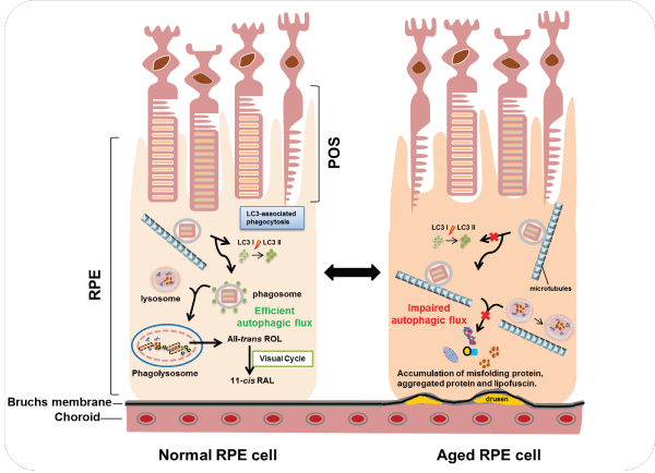 Autophagic Regulation of Retinal Pigment Epithelium Homeostasis | OMICS ...