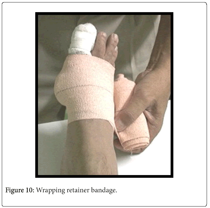 Foot-Ankle-Wrapping-retainer-bandage