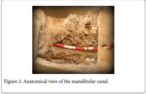 Interdisciplinary-Medicine-Dental-Anatomical-mandibular-canal