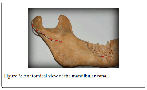 Interdisciplinary-Medicine-Dental-Anatomical-mandibular-canal