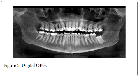 Interdisciplinary-Medicine-Dental-Digital-OPG