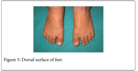 Interdisciplinary-Medicine-Dental-Dorsal-surface-feet