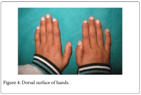 Interdisciplinary-Medicine-Dental-Dorsal-surface-hands