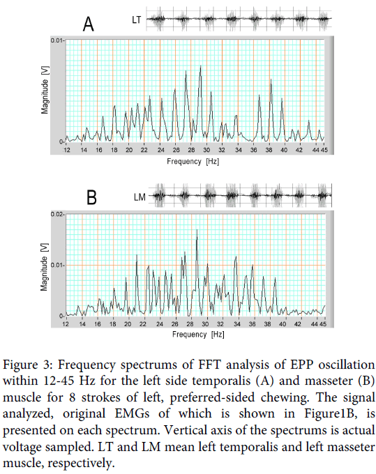 Interdisciplinary-Medicine-Dental-Frequency-spectrums-FFT