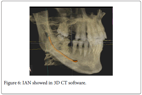 Interdisciplinary-Medicine-Dental-IAN-showed-software