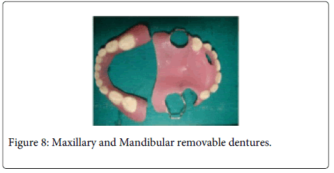 Interdisciplinary-Medicine-Dental-Maxillary-Mandibular-dentures