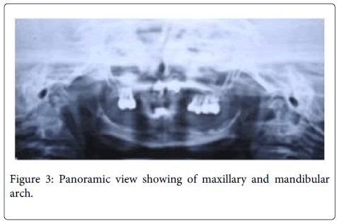 Interdisciplinary-Medicine-Dental-Panoramic-maxillary-mandibular