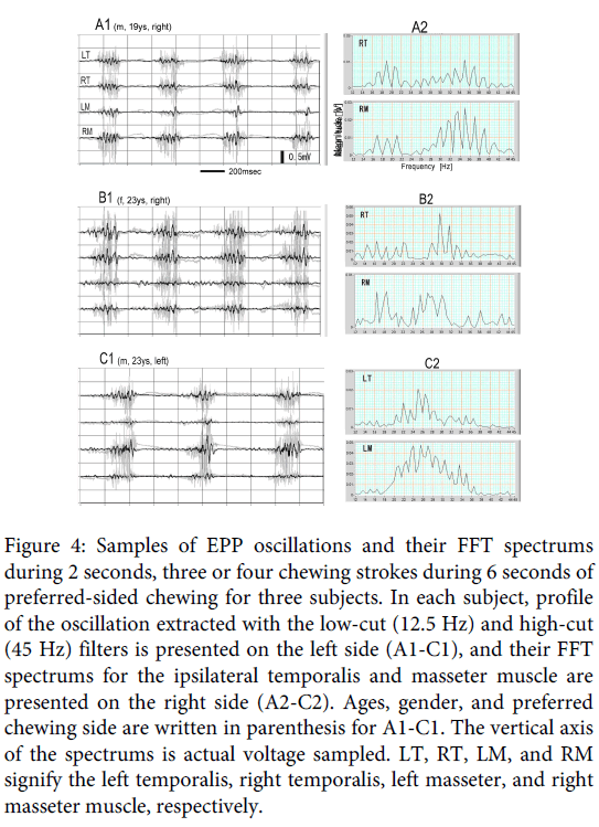 Interdisciplinary-Medicine-Dental-Samples-EPP-oscillations