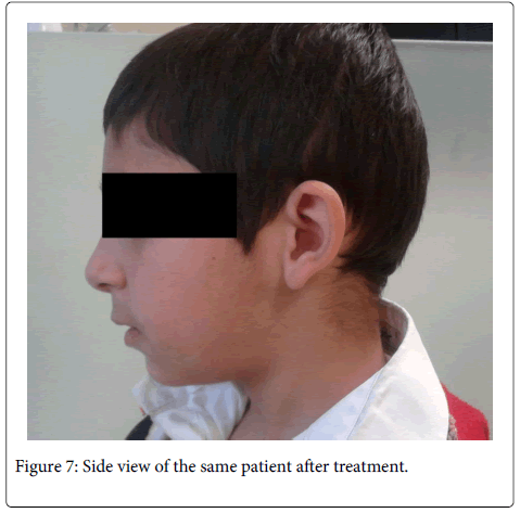 Interdisciplinary-Medicine-Dental-Side-view-same-patient-treatment