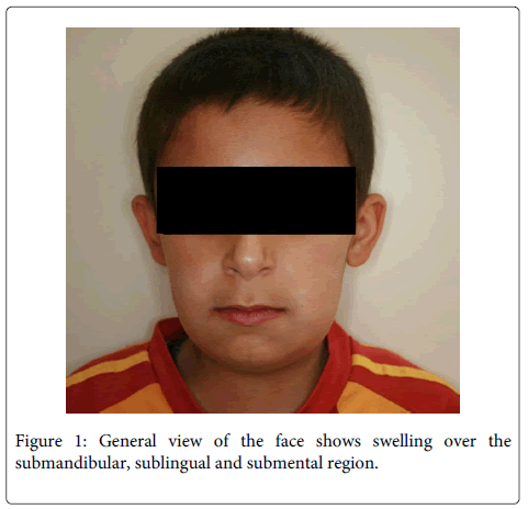 Interdisciplinary-Medicine-Dental-submandibular-sublingual-submental