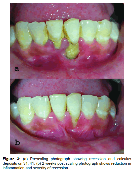 Medicine-Dental-Prescaling-photograph