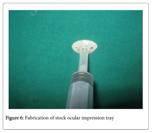 Medicine-Dental-Science-Fabrication-stock-ocular