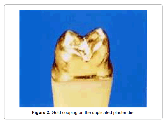 Medicine-Dental-Science-Gold-cooping-duplicated-plaster