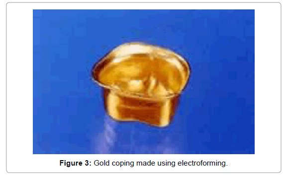 Medicine-Dental-Science-Gold-coping-made-using-electroforming