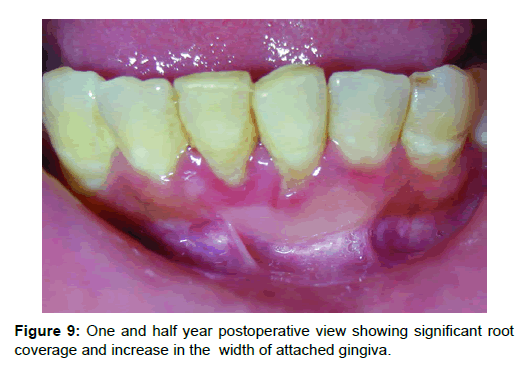 Medicine-Dental-year-postoperative