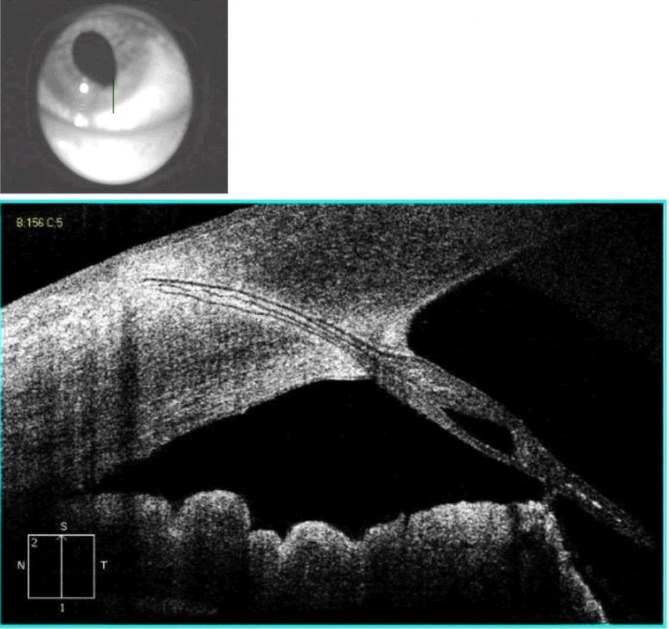 anterior