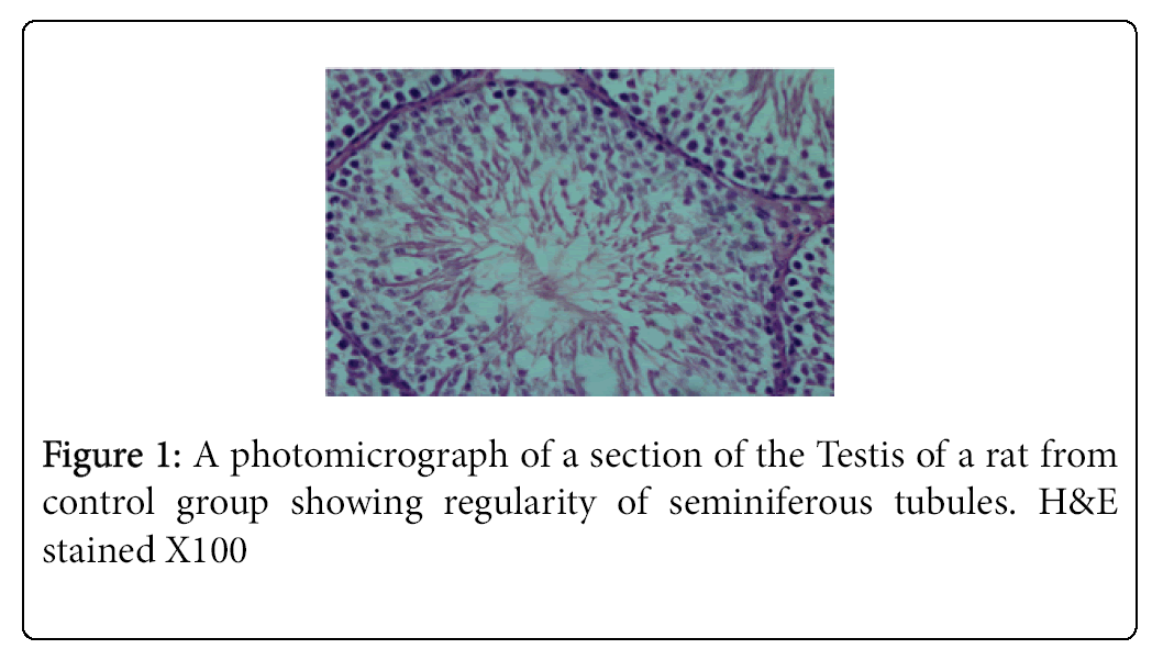 Weight-Loss-photomicrograph-section-Testis-rat