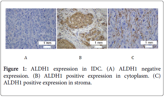 advances-cancer-prevention-expression-IDC