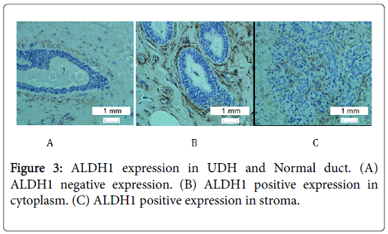 advances-cancer-prevention-expression-UDH