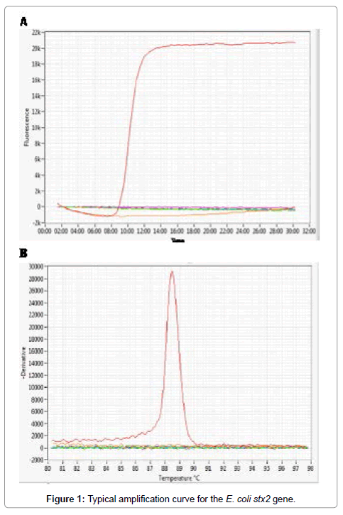 advances-molecular-diagnostics-Typical-amplification-curve