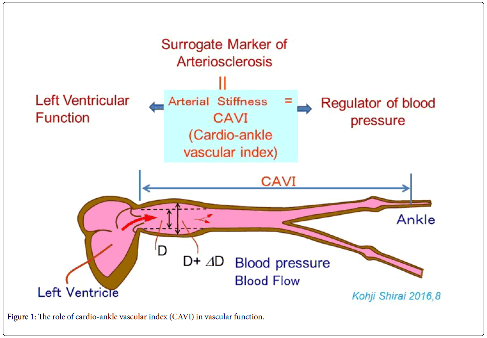 diagnosis-of-macrovascular-complications-in-diabetes-mellitus-using