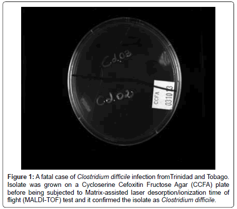 air-water-borne-diseases-fatal-case