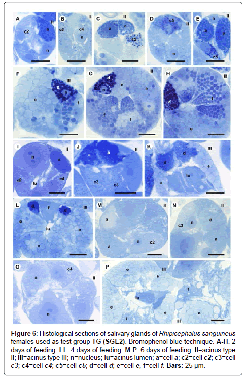 air-water-borne-diseases-histological-sections