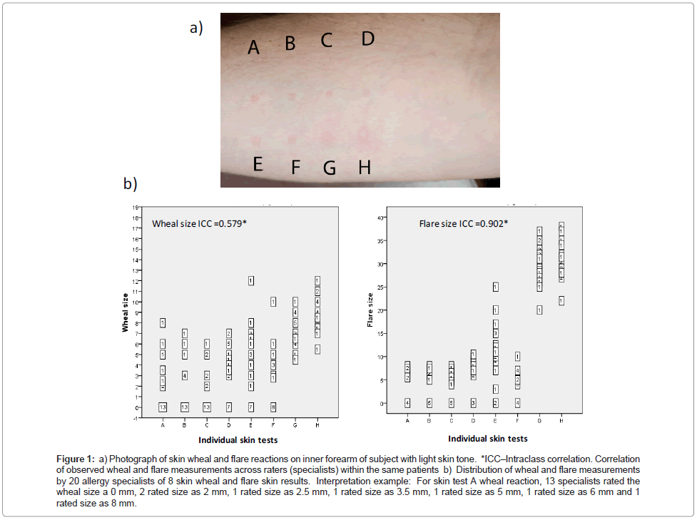 Allergy Wheal Size Chart